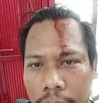 Polsek Bogor Selatan Tolak Laporan wartawan Diduga Bekingi Penjual Obat Keras